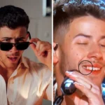 Nick Jonas Teeth
